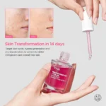 Anua Niacinamide 10% + TXA 4% Dark Spot Correcting Serum - Image 2